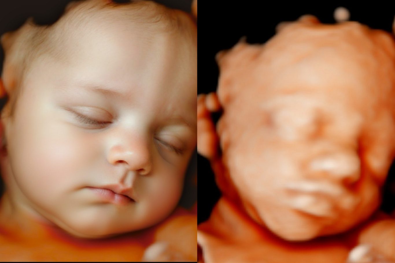 Ecografia 5D y Ultrarrealismo 8K Retrato de un bebé dormido, mostrando dos ángulos diferentes de su rostro.