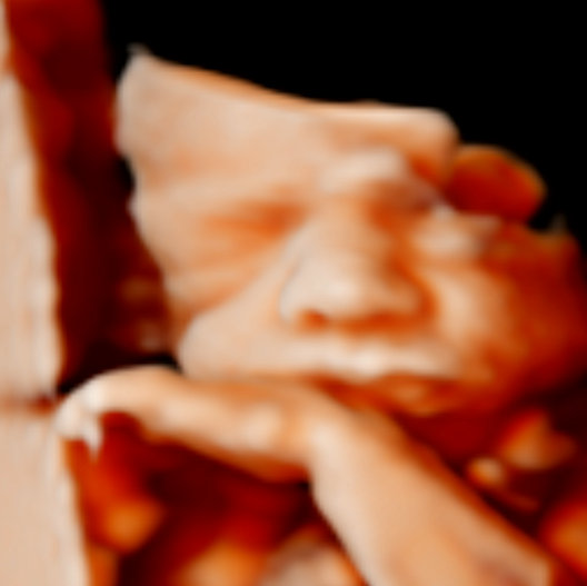 Feto en posición fetal, con detalles faciales visibles y mano cerca de la cara.